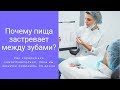 Пища застревает между зубами. Как справиться самостоятельно?