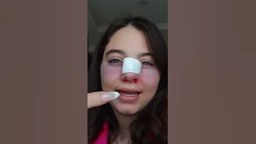 بيسان اسماعيل عملت عملية تجميل 