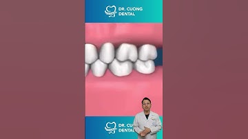 Hậu quả của việc mất răng |Dr Cường Official
