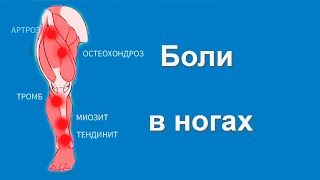 Боли в Ногах