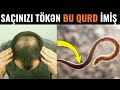 Qurddan qurtulmağın yolları - Təbii üsulla müalicə