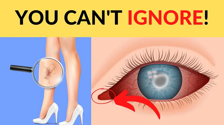 10 Signs of Heart Failure You Should Never Ignore.