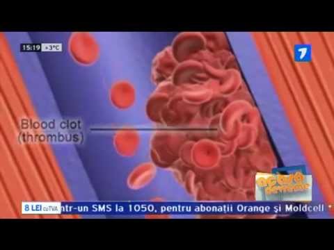 Video: Sânge Gros (hipercoagulabilitate): Cauze, Tratament și Test