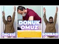 Donuk Omuz Rahatsızlığı - Seans Öncesi ve Sonrası