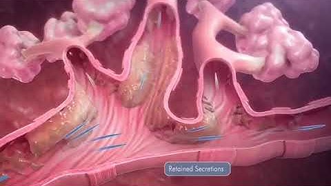 HFCWO Technology Mechanism