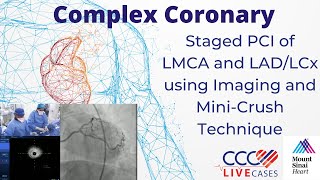 Staged PCI of LMCA and LAD/LCx using Imaging and Mini-Crush Technique