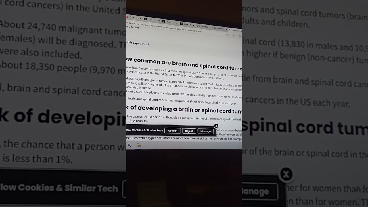 Elon Musk this is bullshit grok glitches . brain tumors cancer death cause for ages 0-19. PART 2