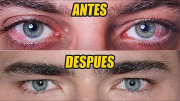 ¿Cómo puede un hombre tener unos ojos bonitos?