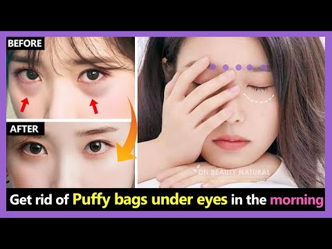 Only 2 Mins!! How to get rid of Puffy bags under eyes and Swollen under eyes in the morning quickly.