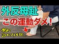 【衝撃】実はその運動が外反母趾を悪化させている　｜京都市北区　もり鍼灸整骨院