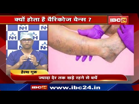 Varicose Veins के Risk Factors क्या हैं? जानिए क्यों होता है वैरिकोज वेन्स?Health Tips | Health Guru