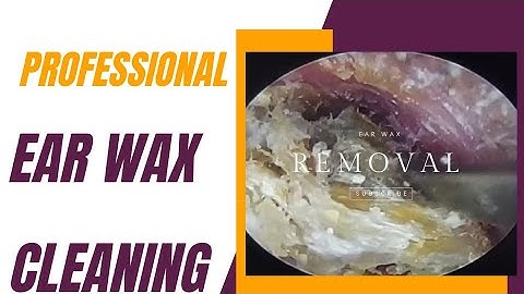 #56 Deep Ear Wax Removal ASMR 