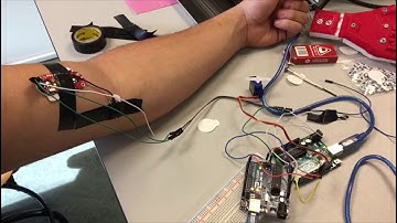 Move servo motor with EMG sensor Arduino