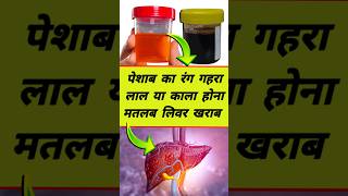 पेशाब के रंग से पता करें लिवर खराब है या स्वास्थ्य | Urine colour & liver health. #shorts