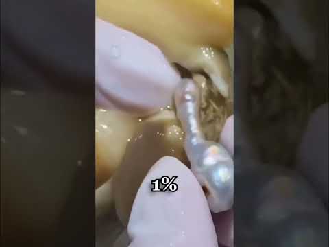 How Oysters Are Tricked Into Making Pearls #shorts