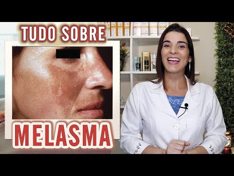 tratamento para melasma