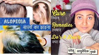 Alopecia Areata & Hair Loss Natural Treatment : बालों का झड़ना और गंजापन ठीक करें आयुर्वेदिक तरीके से screenshot 4