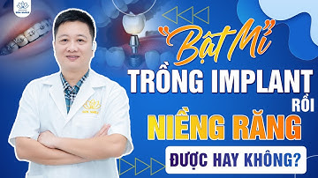 Bật Mí Trồng Răng Implant Rồi Thì Có Niềng Răng Được Hay Không? | Nha Khoa Sen Smile