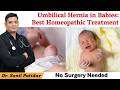 Umbilical Hernia in New Born Baby or Child | Homeopathic Treatment by Dr Patidar #umbilicalhernia
