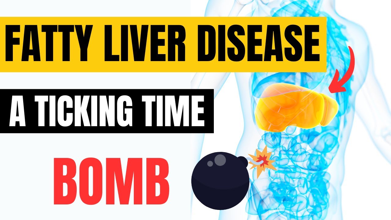 Fatty Liver Disease: A Ticking Time Bomb | Ignite Weight Loss Now to Save Your Liver and Your Life.