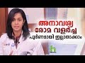 അനാവശ്യ രോമ വളർച്ച പൂർണമായും ഇല്ലാതാക്കാം | Laser Hair Removal Malayalam Health Tips