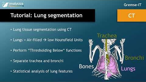 Tutorial video (CT): "Lung segmentation"