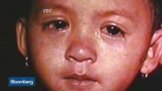 Measles Outbreak: The Social and Economic Costs Measles Outbreak: The Social and Economic Costs
