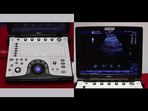 How to end an exam on the GE logiq e ultrasound scanner - video 7