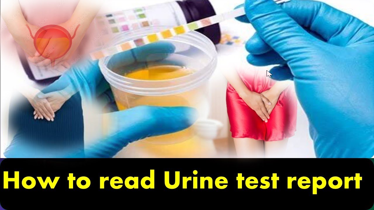 How To Read Urine Test Report Why Test Reasons YouTube How To Read Urine Test Report Why Test Reasons YouTube