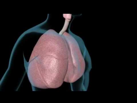 Video: Histoplasmosis - Ordbog Over Medicinske Termer