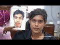 Face Change After Plastic Surgery in India | Facemakeover - Before And After Results