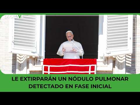 POPE LEO XIV TO UNDERGO LUNG NODULE SURGERY