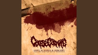 Download Lagu Grotesque Examination: Amputee Germination Download Lagu Grotesque Examination: Amputee Germination