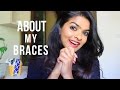 MY BRACES STORY | EXPERIENCE SO FAR | HOW & WHY I GOT IT