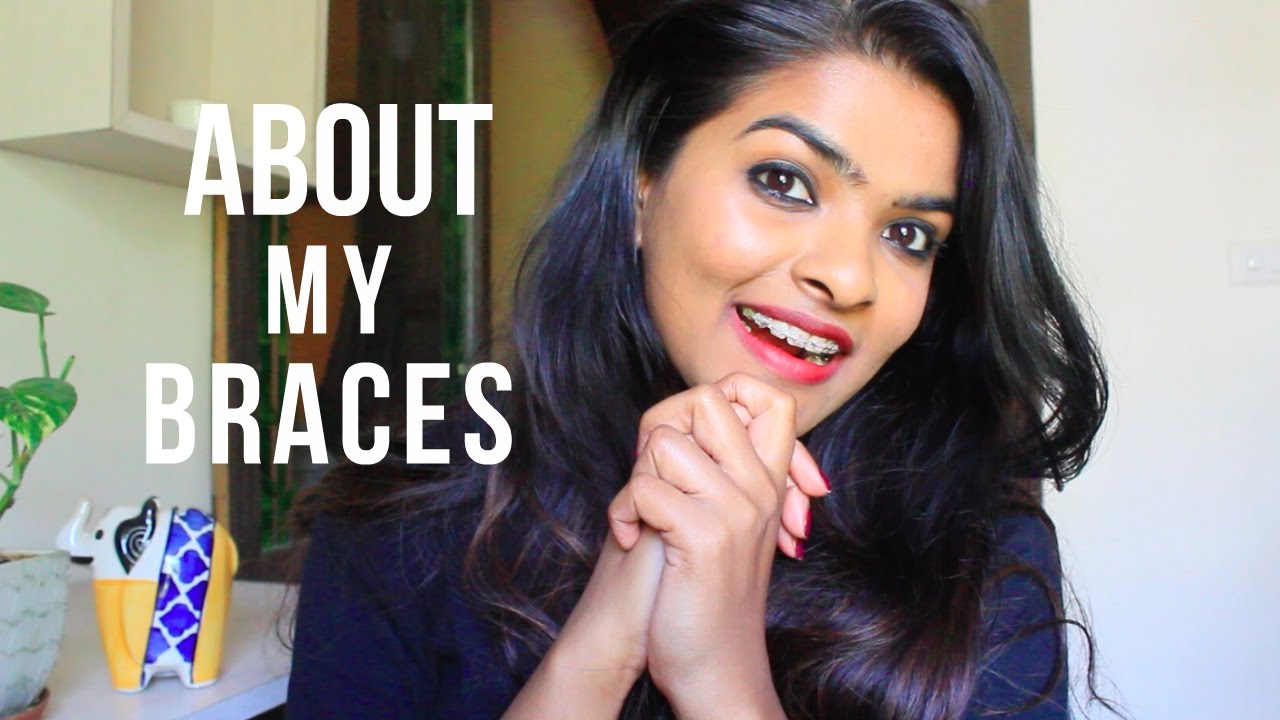 MY BRACES STORY EXPERIENCE SO FAR HOW & WHY I GOT IT YouTube