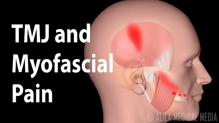 TMJ and  Myofascial Pain Syndrome, Animation. - DayDayNews