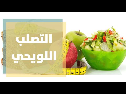 فيديو: 3 طرق لاتباع نظام غذائي صحي لمرض التصلب المتعدد