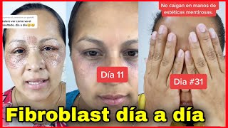 Fibroblast día a día - si funciona? Vale la pena?