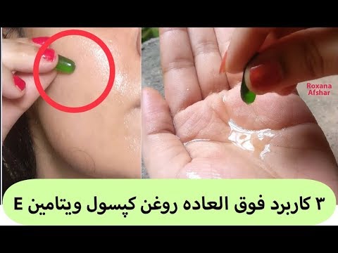 تصویری: نحوه تعیین جنسیت توله سگ: 11 مرحله