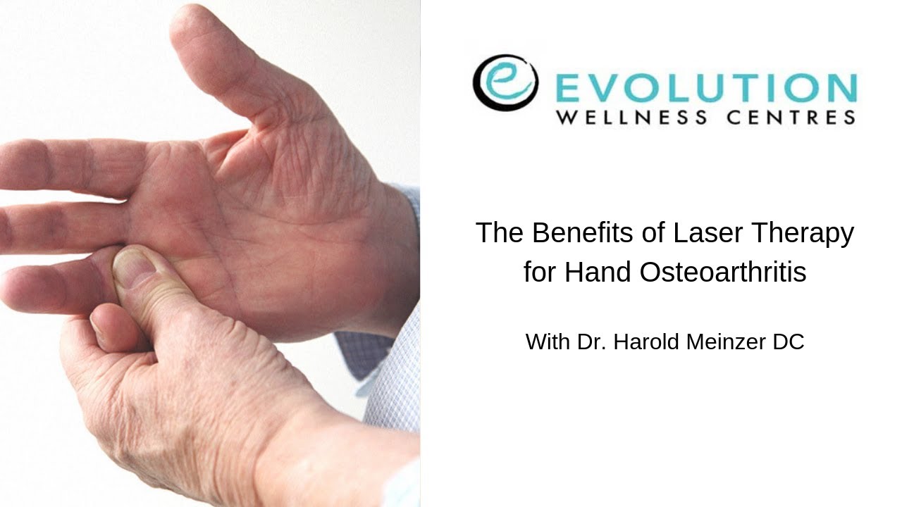 The Benefits Of Laser Therapy For Hand Osteoarthritis