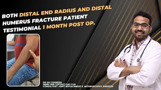 Both Distal End Radius And Distal Humerus Fracture Patient Testimonial 1 Month Post Op.#drsaichandra