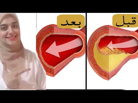 اهم اطعمه و عناصر طبيعية لتوسيع الشرايين خفض الكوليسترول الضار و الدهون الثلاثيه حماية القلب