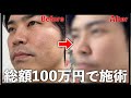 美容整形クリニックへ男友達を連れて行ったら泣いてしまった…
