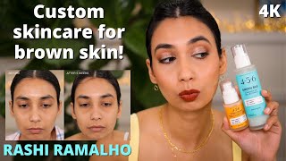 Custom Skin Care for Brown Skin for Smoother, Brighter &amp; Even Skin | 4.5.6 Skin