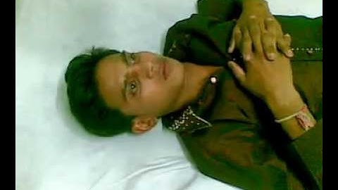 Rabies Patient ....Classical aerophobia with acute hydrophobia