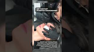 Как работает лазерное омоложение #рек #брови #юмор #тату #удаление #татуаж #процедура