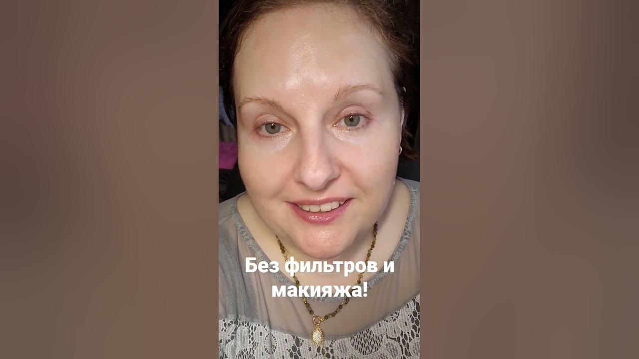 Девочка которой кололи ботокс. Девочка которой кололи ботокс