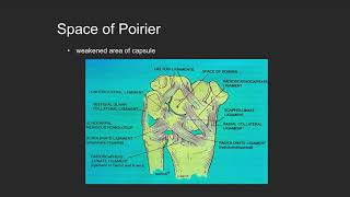 Carpal Instability - ABOS Orthopedic Surgery Board Exam Review