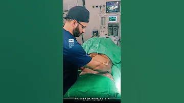 شد البطن بعد العملية مباشرة 