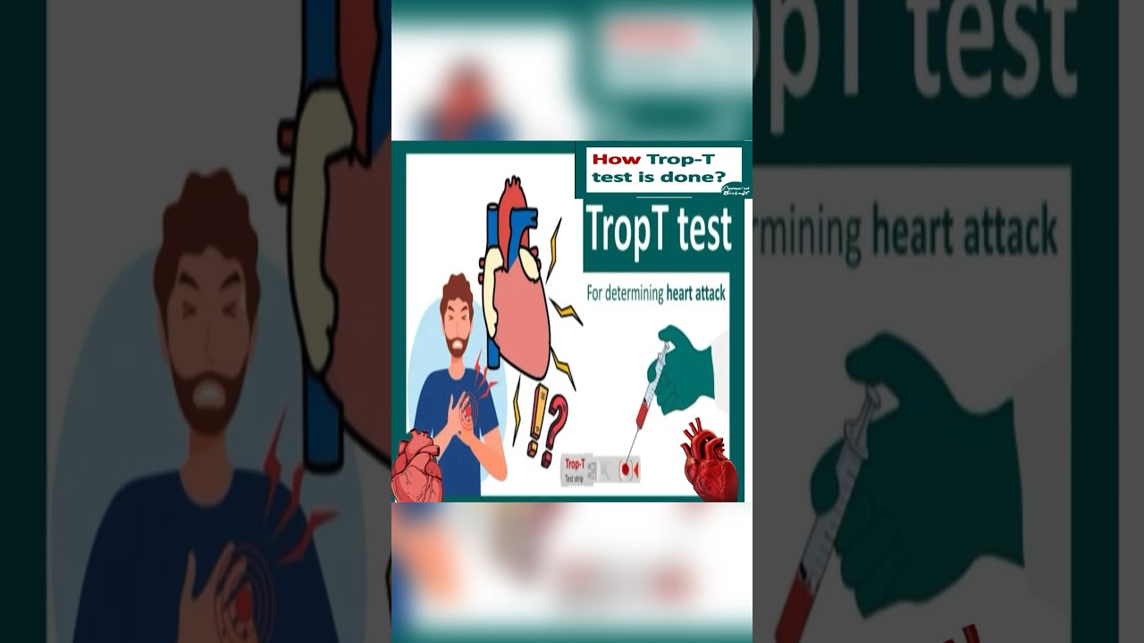Trop T test What if Trop T test is positive? Troponin T blood test 